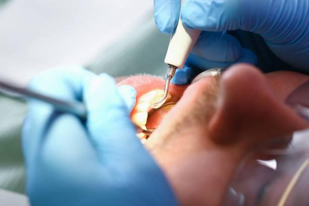 Best Emergency Root Canal Treatment in Brinkley, AR